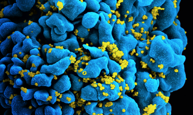 Health: London Patient is World’s Second Case of HIV Remission