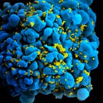 Health: Meet the ‘London Patient,’ the 2nd Person Cured of HIV